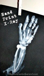 Hand print X-ray